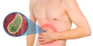 Colecistitis aguda